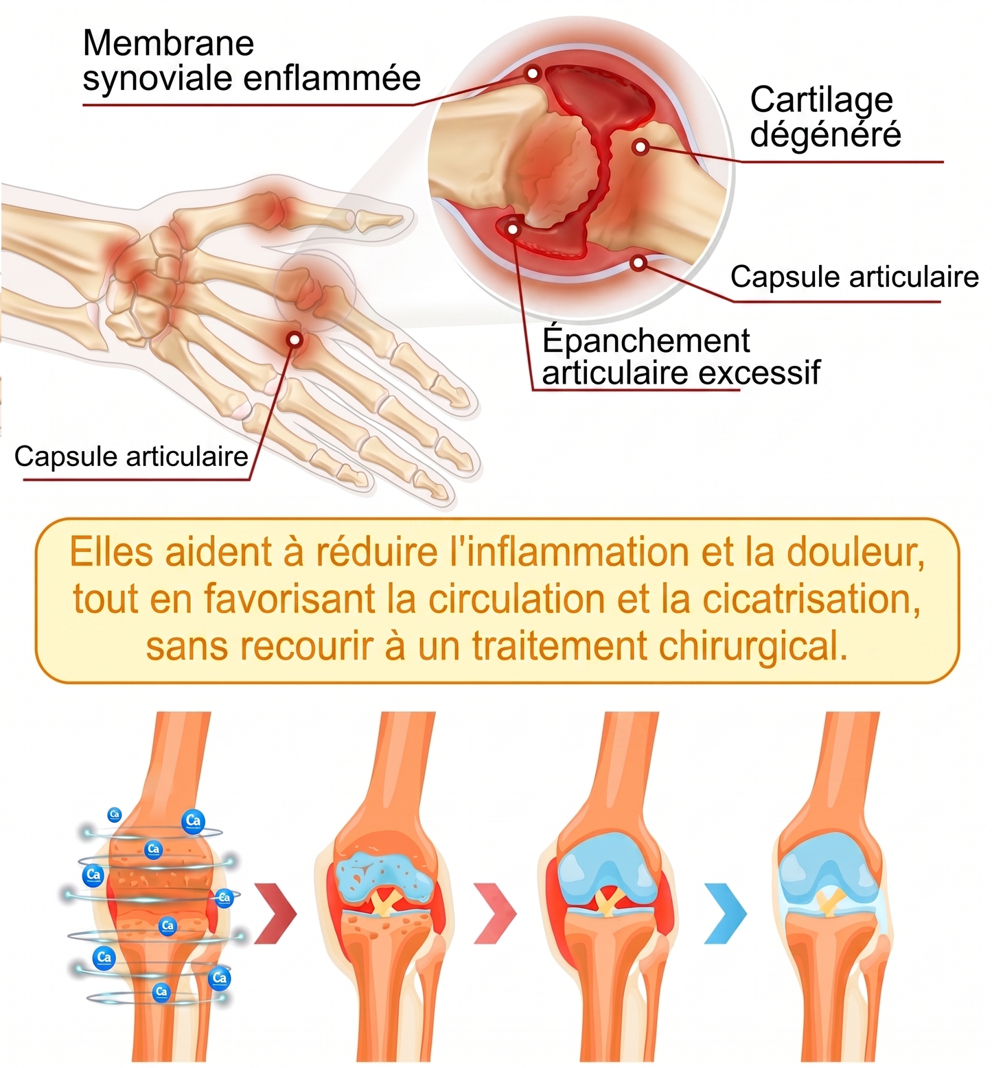 30 % de réduction 🎁🎁 | Crème 𝐌𝐔𝐑𝐖𝐎𝐍® au venin d’abeille pour soulager les douleurs et favoriser le bien-être articulaire ✨✨✨ (Spécialement pour les seniors)
