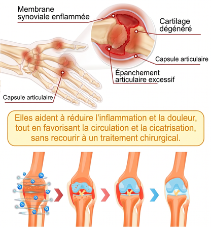 30 % de réduction 🎁🎁 | Crème 𝐌𝐔𝐑𝐖𝐎𝐍® au venin d’abeille pour soulager les douleurs et favoriser le bien-être articulaire ✨✨✨ (Spécialement pour les seniors)