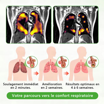 𝐃é𝐭𝐞𝐧𝐮𝐞 𝐞𝐭 𝐞𝐱𝐩𝐥𝐨𝐢𝐭é𝐞 𝐩𝐚𝐫 𝐥𝐚 𝐅𝐫𝐚𝐧𝐜𝐞✅ 𝑴𝒖𝒓𝙬𝙤𝐧® 𝑫𝒊𝒇𝒇𝒖𝒔𝒆𝒖𝒓 𝒅𝒆 𝑵𝒆𝒕𝒕𝒐𝒚𝒂𝒈𝒆 𝑷𝒖𝒍𝒎𝒐𝒏𝒂𝒊𝒓𝒆 à 𝒍𝒂 𝑴𝒐𝒍è𝒏𝒆 𝑩𝒐𝒕𝒂𝒏𝒊𝒒𝒖𝒆 (🫁 Toux, Pharyngite, essoufflement, expectorations, nez bouché, bronchite, symptômes allergiques, gêne pulmonaire)6🌈